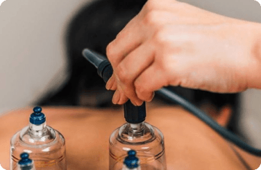 Full Body Massage & Bekam